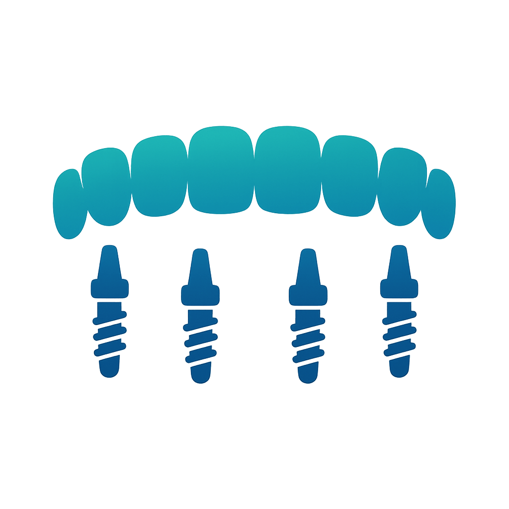 Full Arch Implants (All-on-4 / All-on-6)